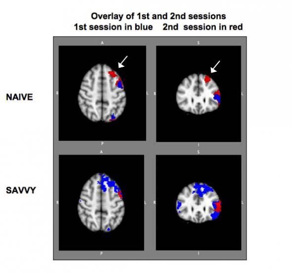 **Figure: Participants with Minimal Online Experience**. Participants with minimal online experience displayed brain activation patterns very similar to those seen in the group of savvy Internet users - after just a brief period of time. ---Image Credit: Faith Brynie, Psychology Today (Brain Sense).