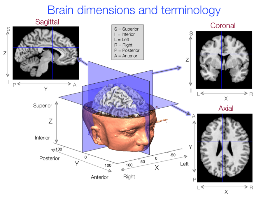 Figure 7.3. A basic orientation to anatomical brain slices and their spatial relation to the overall head and brain surface