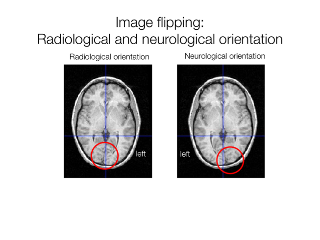 Figure 7.9. The same brain slice shown in radiological and neurological format.