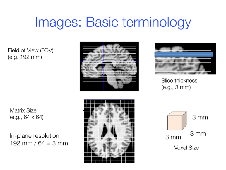 Figure 7.2. Basic terminology related to MR image acquisition.